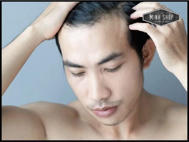 Mẫu tóc ngắn trán cao nam với phần mái tạo độ che phủ tự nhiên