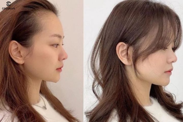 Tóc mái dài rẽ nhẹ hai bên giúp che khuyết điểm trán cao, gò má rộng và làm gương mặt trông thon gọn hơn