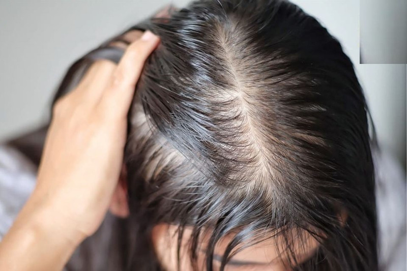 Tóc ngắn layer nữ không phù hợp với tóc quá mỏng