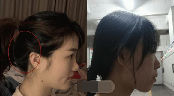 Vị trí buộc đuôi ngựa lý tưởng giúp che đầu bẹt một cách khéo léo