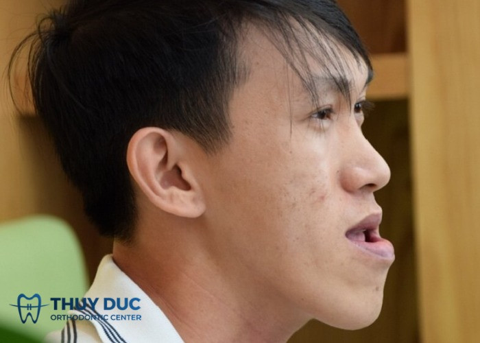 Đàn ông với khuôn mặt lưỡi cày được cho là khó thành công theo tướng số