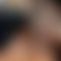 Góc nhìn phía sau của kiểu tóc ivy side part nam tính