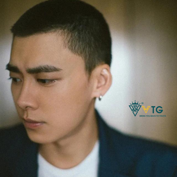 Kiểu tóc 3 phân (Crew Cut) gọn gàng, phù hợp cho người có trán hói chữ M