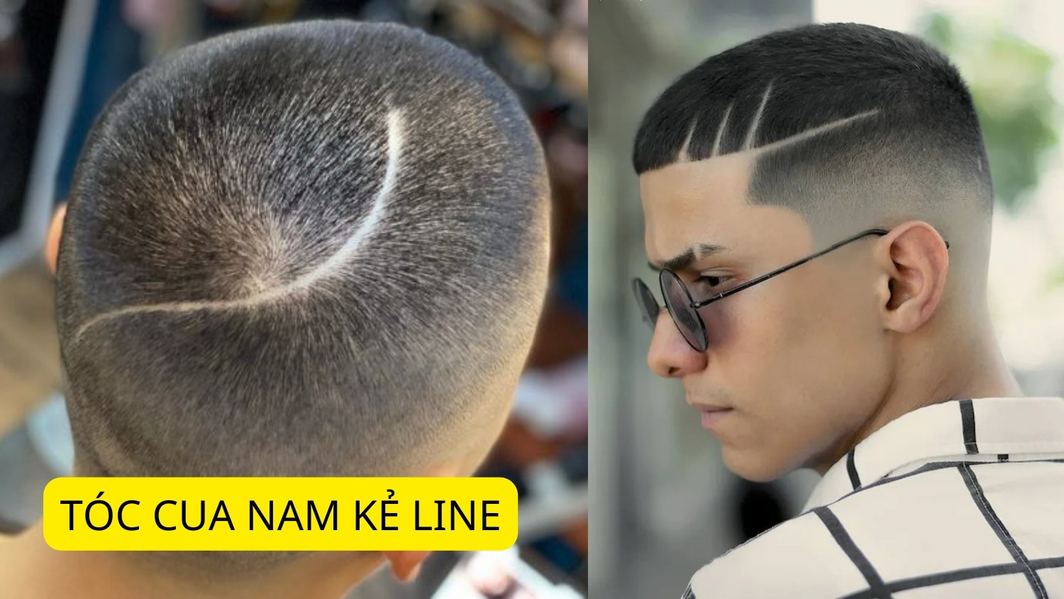 Kiểu tóc cua nam kẻ line