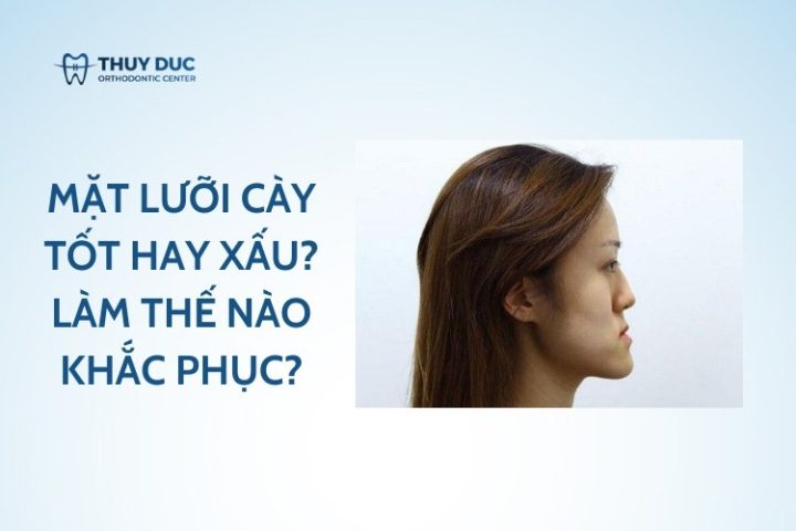 Mô tả đặc điểm gương mặt lưỡi cày